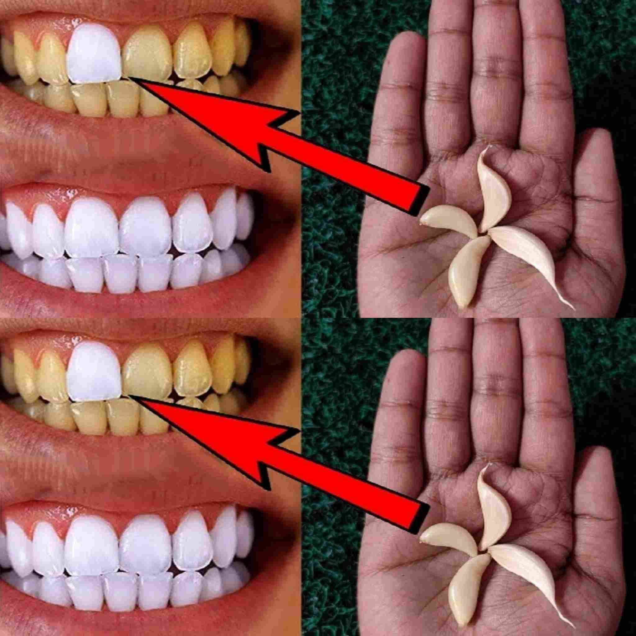 Как использовать чеснок для отбеливания зубов ?