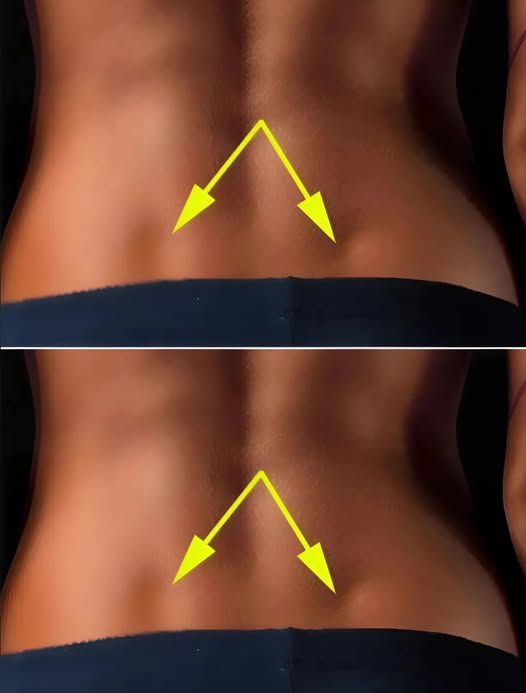 Если у вас есть эти ямочки внизу спины, вот что нужно знать: их истинное значение